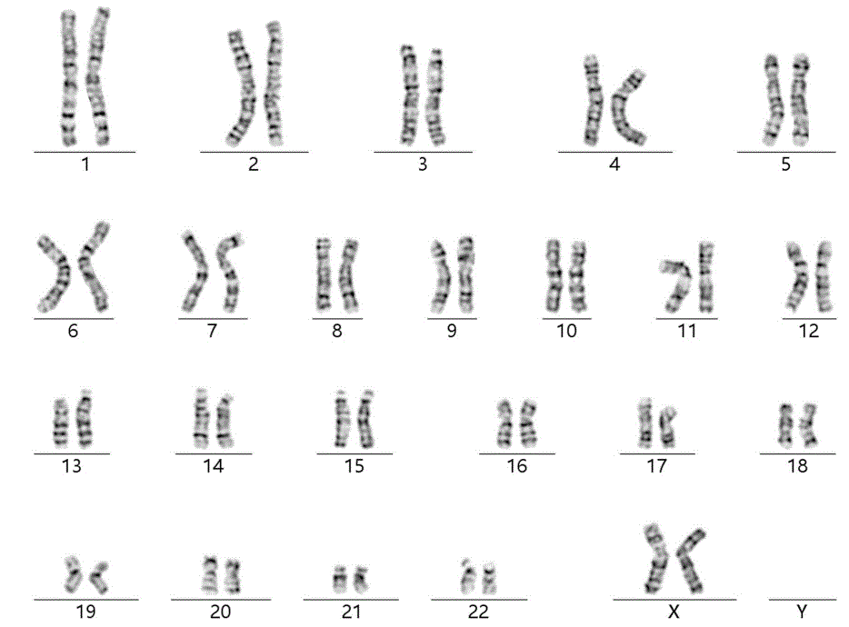 Schematic diagrams of normal chromosomes of the fetus.