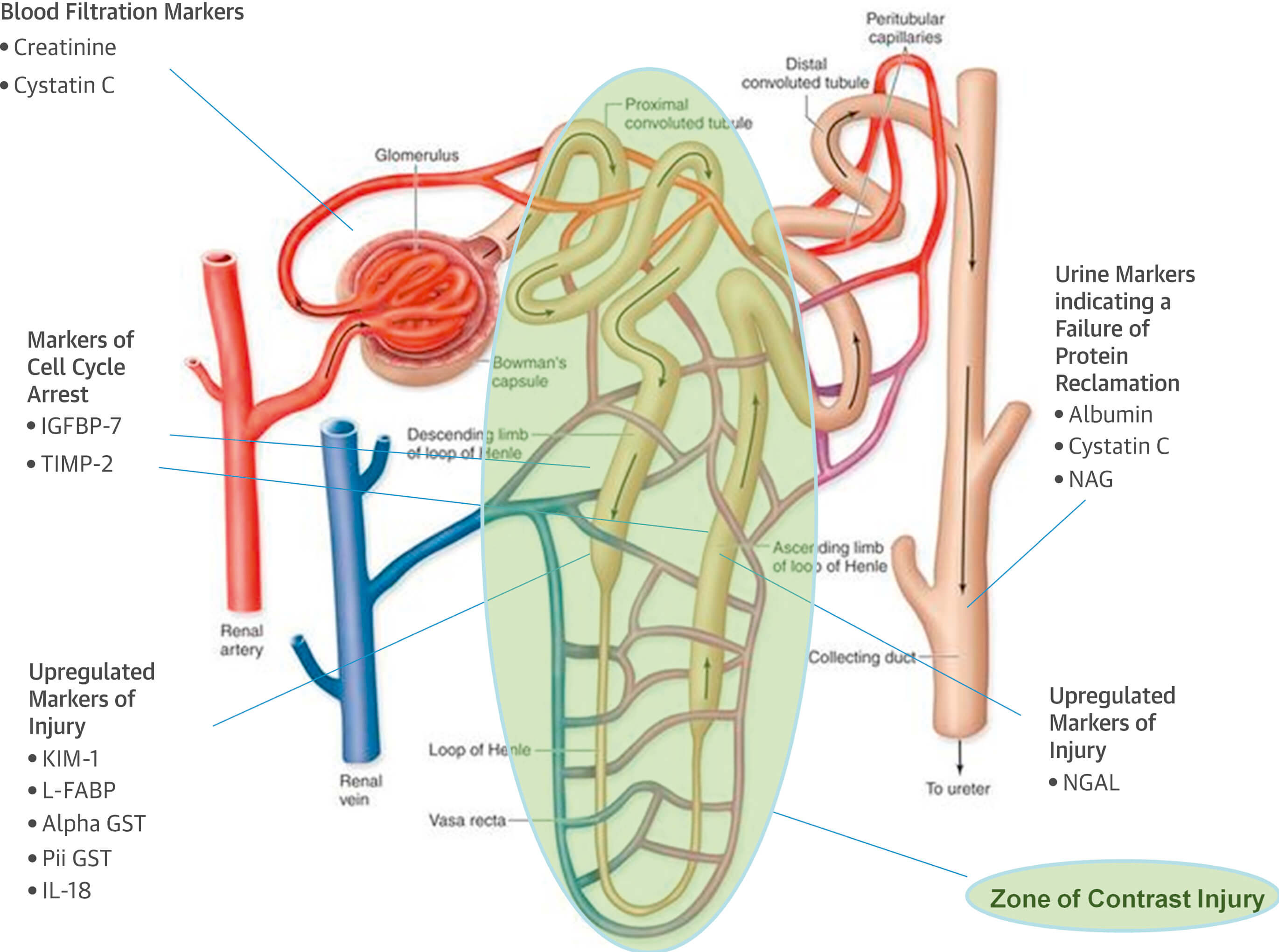 Anatomy of a Single Nephron and Location of Novel and Conventional Biomarkers of Renal Filtration and Tubular Epithelial Cell Damage.