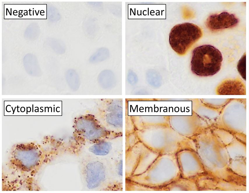 Immunohistochemistry staining.