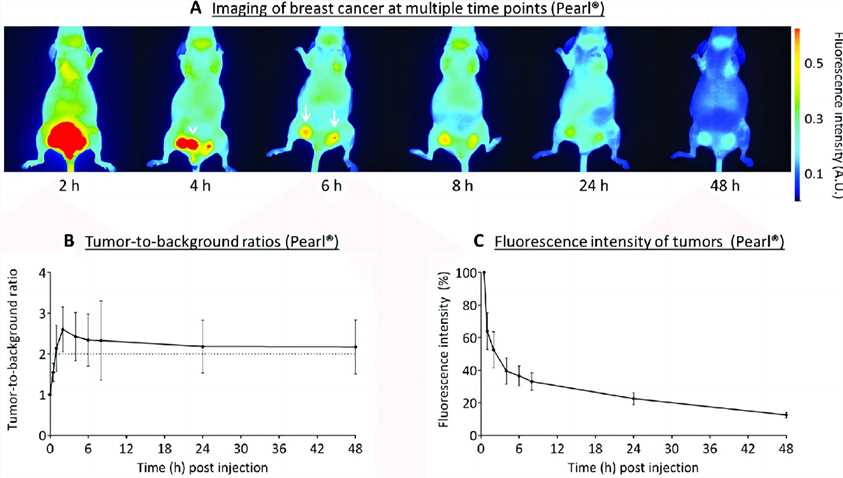 Near-infrared fluorescence imaging of breast cancer.