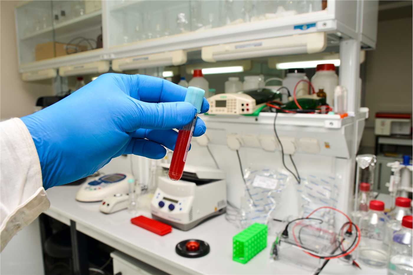 Polyclonal antibody development at Creative Biolabs. (Creative Biolabs Authorized)