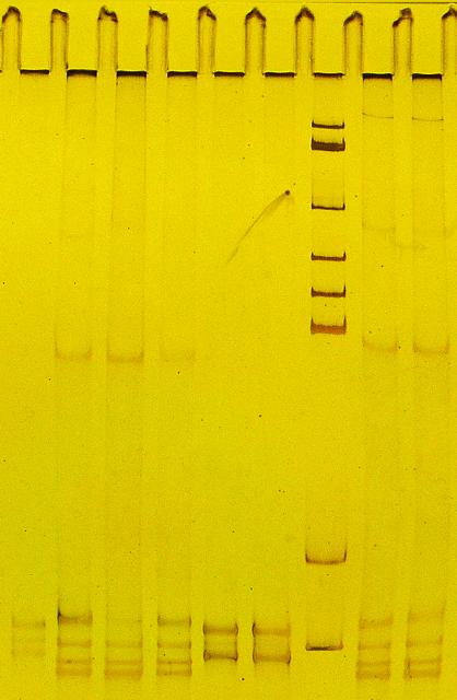 A single-strand conformation polymorphism gel where DNA was stained with silver staining.