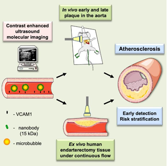 Ultrasound molecular imaging of atherosclerosis with sdAbs.