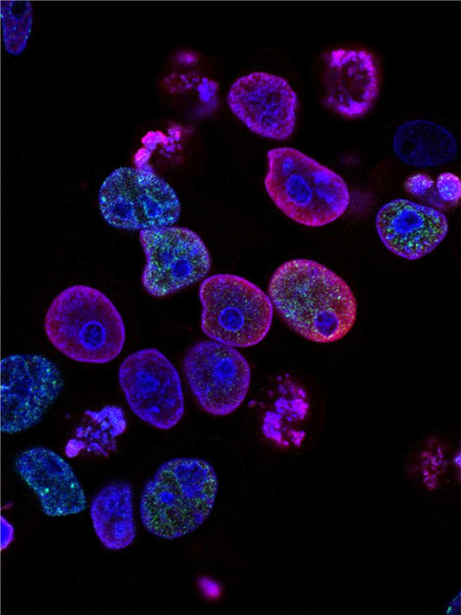 Fig.4 Schematic diagram of aptamer function. (Creative Biolabs Authorized)