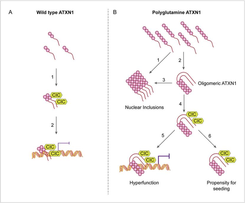 ATXN1 disease progression in SCA1.