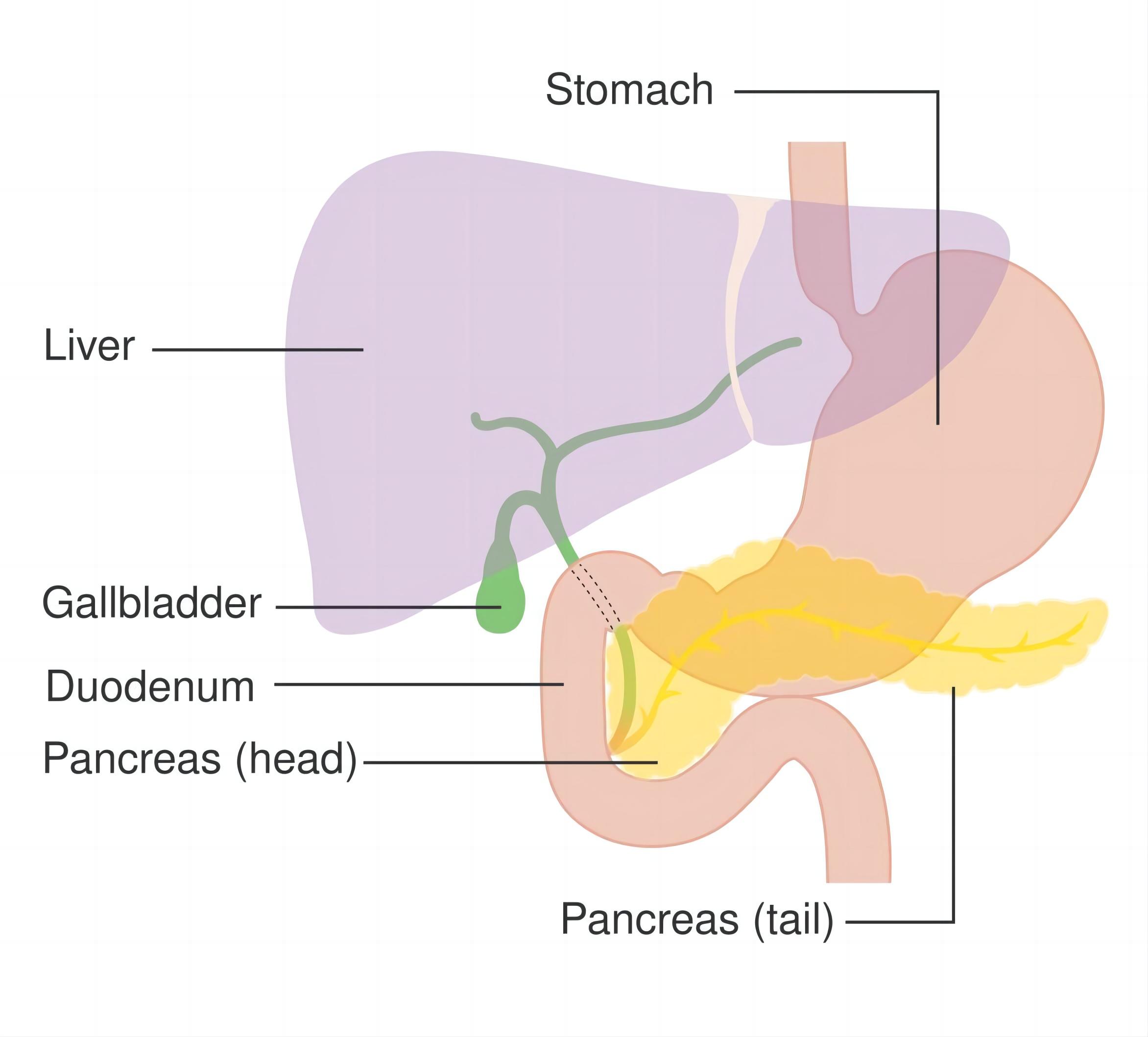 Fig.4 Pancreatic cancer. (From Wikipedia: By Cancer Research UK - Original email from CRUK, https://commons.wikimedia.org/wiki/File:Diagram_showing_the_position_of_the_pancreas_CRUK_356.svg)