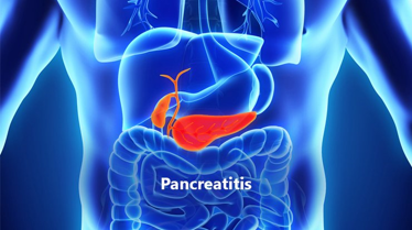 Biomarker and Antibody Development for Acute Pancreatitis