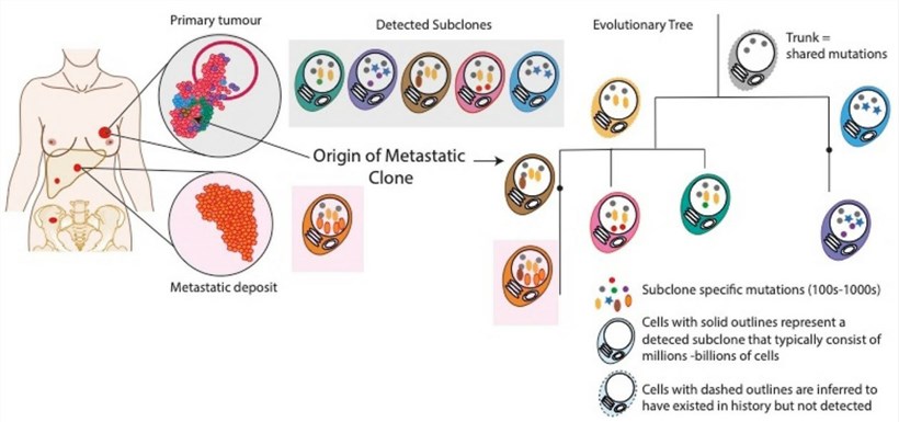 Evolutionary or phylogenetic trees provide a map of breast cancer development and progression.