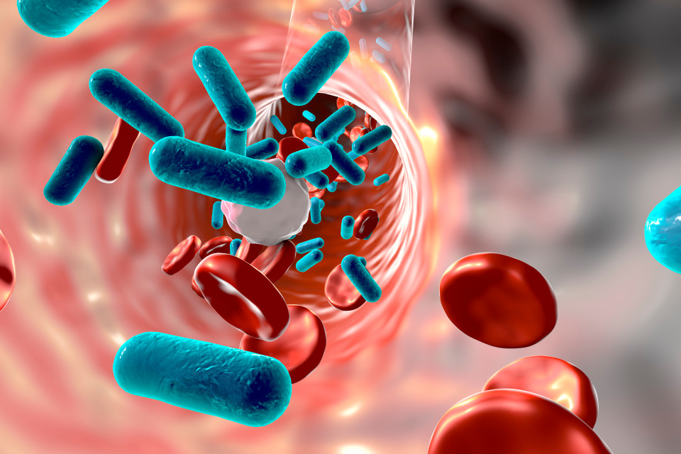 Biomarkers and Antibodies Development for Sepsis Infections