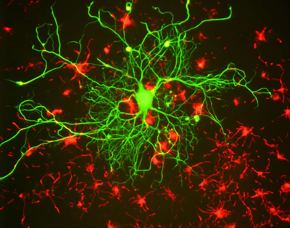 Fig.1 Immunostaining of cortical neuron. (From Wiki: By GerryShaw - Own work, https://commons.wikimedia.org/wiki/File:Neuron_in_tissue_culture.jpg)