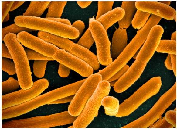 Fig.1 E. coli. colonial morphology. (https://commons.wikimedia.org/wiki/File:E._coli_Bacteria_(16598492368).jpg)