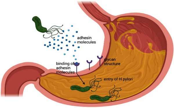 Fig.2 Pathogenesis of Helicobacter pylori infection. (Lenka and Ruchi, 2022)