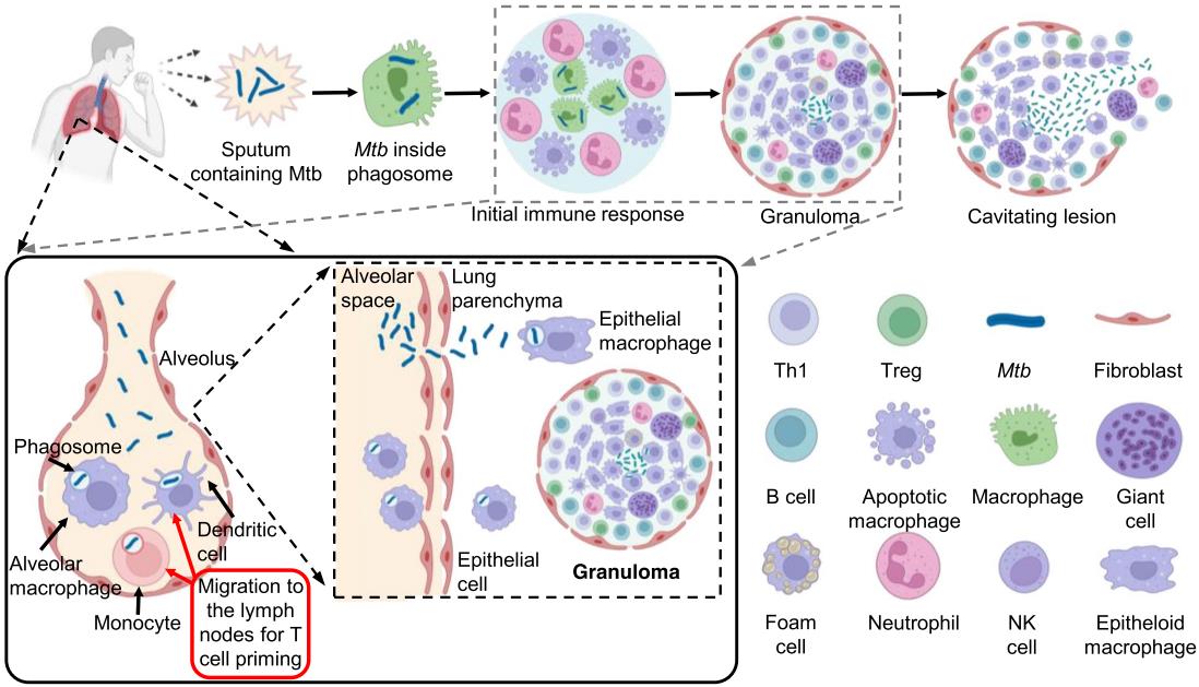 Fig.1 M. tuberculosis pathogenesis. (Yan, et al., 2022)