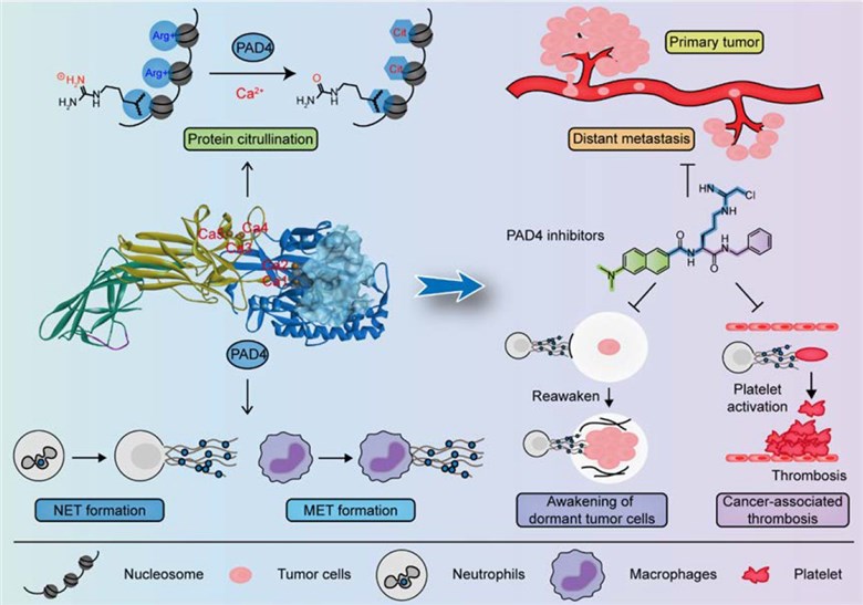 PAD4 and its inhibitors play important parts in progression and prognosis of cancers.