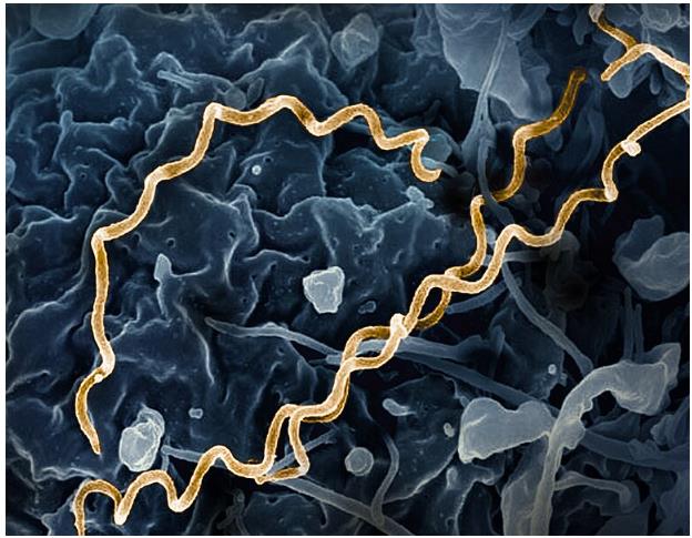 Fig.1 The T. pallidum morphology, highlighted in gold. (https://commons.wikimedia.org/wiki/File:Treponema_pallidum_Bacteria_(Syphilis).jpg)