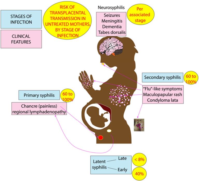 Fig.2 Syphilis infection during pregnancy. (Sankaran, Elizabeth and Satyan, 2023)