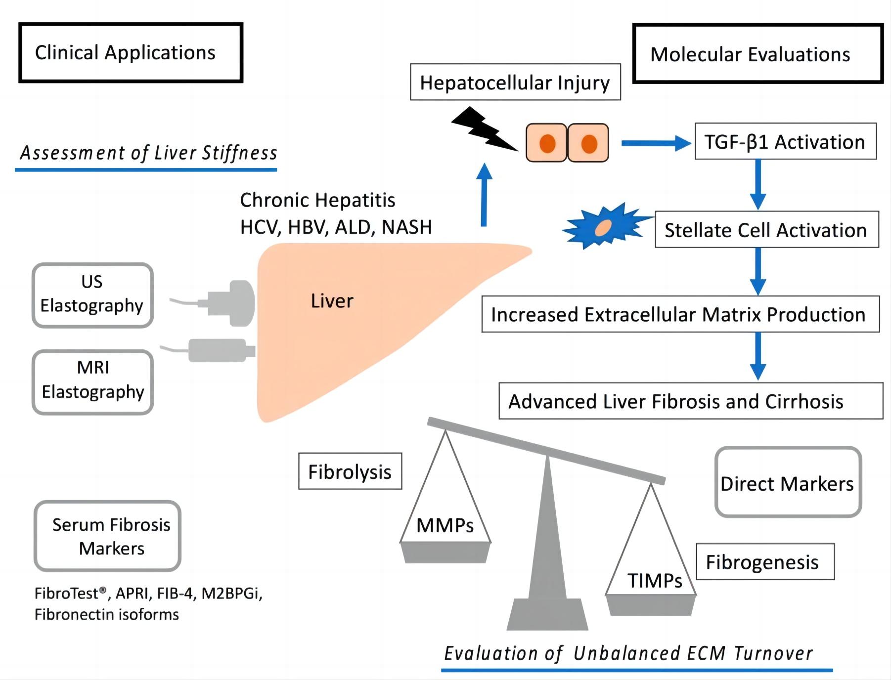 Fig.2 Liver fibrosis. (Masuzaki, et al., 2020)