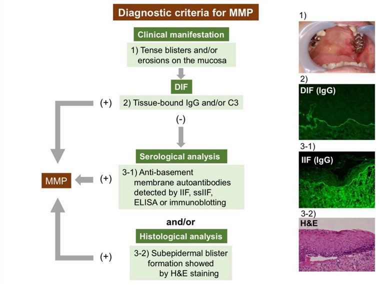 Diagnostic citeria based on MMP.