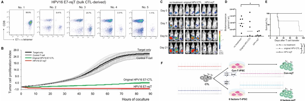 Brain tumor development following stem cell therapy. (OA Literature)