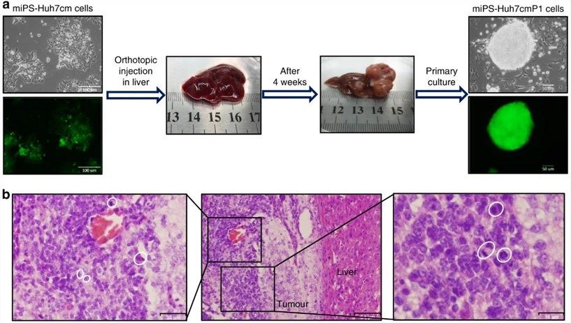 Visualization of liver tumor formation 4 weeks after orthotopically injecting 4-week-conditioned miPS-Huh7cm cells. (OA Literature)
