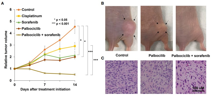 Efficacy of AAV-sh-PPY combined with anti-PD-1 therapy in an osteosarcoma PDOX model. (OA Literature)