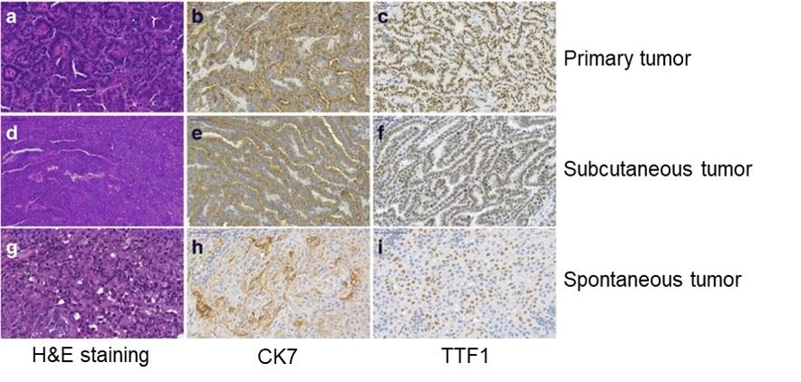 DEN induces lung adenocarcinoma. (OA Literature)
