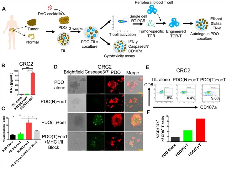 A co-culture system of tumor organoids and autologous tumor-infiltrating lymphocytes (TILs). (OA Literature)