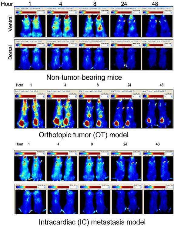 The distribution of DiR labelled liposomes in non-tumor-bearing mice IC model and OT model. (OA Literature)