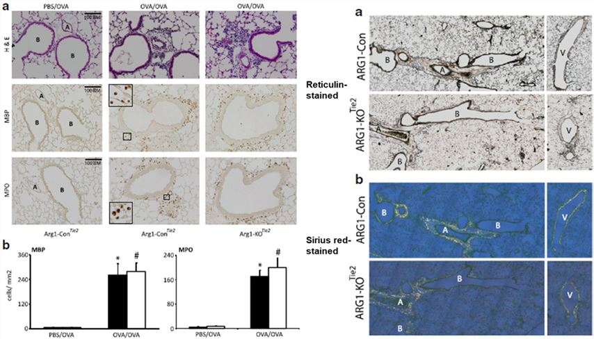 Fig.2 Myeloid ARG1 deletion did not affect inflammatory cell numbers or early lung remodeling in asthmatic female mice. (OA Literature)