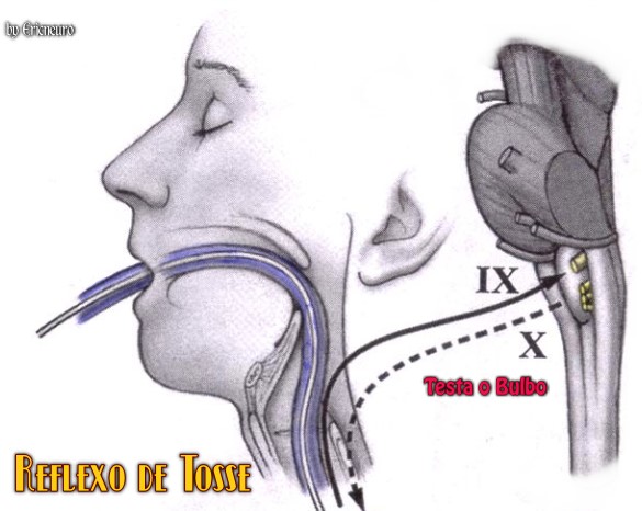 Fig.1 A picture of the cough reflex. (Wikimedia Commons Original)