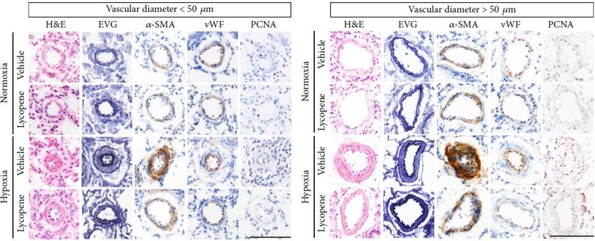 Fig.3 H&E staining, EVG staining, and immunohistochemistry results. (OA Literature)