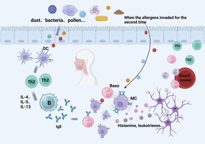 Fig.1 Mechanism of allergic rhinitis. (OA Literature)