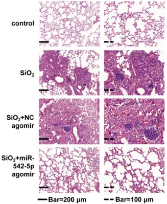 Fig.2 Role of miR-542-5p in Silicon Dioxide (SiO2)-induced pulmonary fibrosis. (OA Literature)