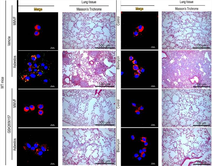Fig.2 Pathology features of asbestos- and bleomycin induced models (OA Literature)
