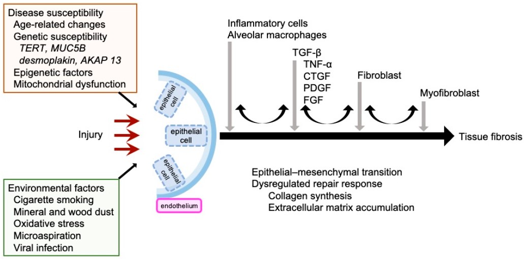 Fig.1 IPF mechanism. (OA Literature)