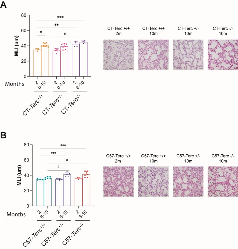 Fig.2 Investigating lung parenchyma structure in Terc mutant mice. (OA Literature)
