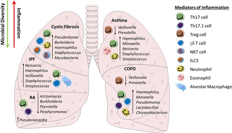 Fig.1 IL-17-type systemic inflammation in the lungs. (OA Literature)