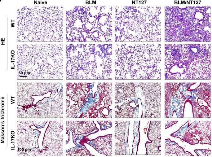 Fig.2 Pathologies of lungs in WT and IL-17 KO mice. (OA Literature)