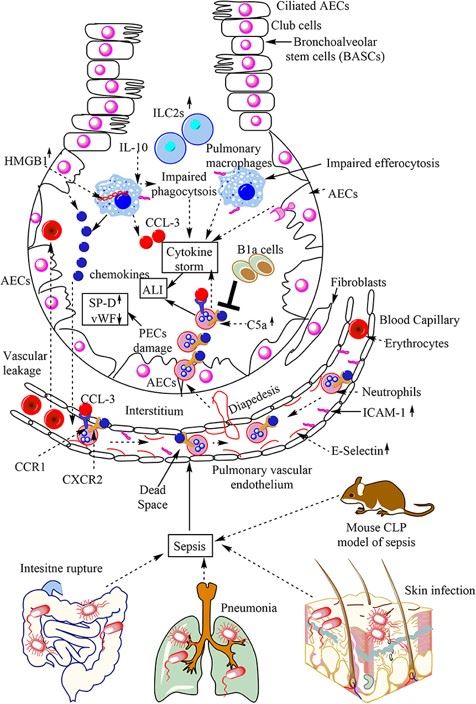 Fig.1 Overview of sepsis-induced lung injury and pneumonia. (OA Literature)
