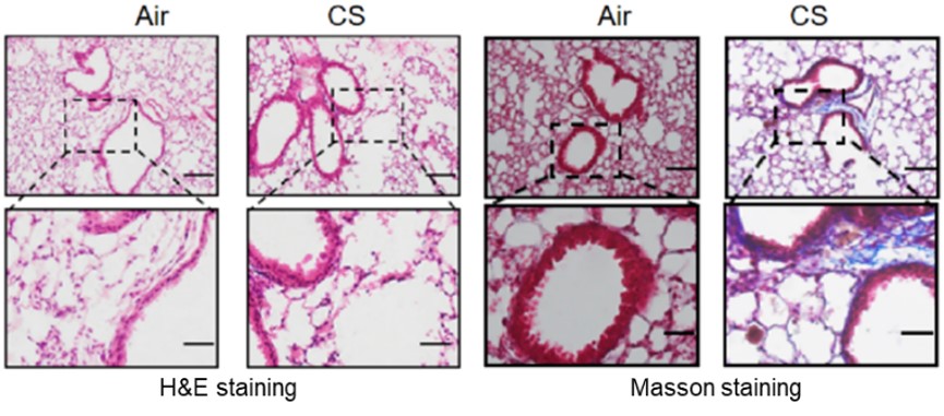 Fig.2 The pulmonary histopathology of the cigarette smoke-induced COPD model. (OA Literature）