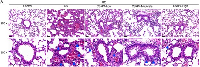 Fig.4 The results of P4 protected CS-induced COPD mouse model. (OA Literature)