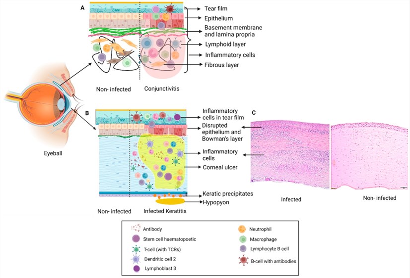 Fig.1 Ocular tissue infection. (OA Literature)