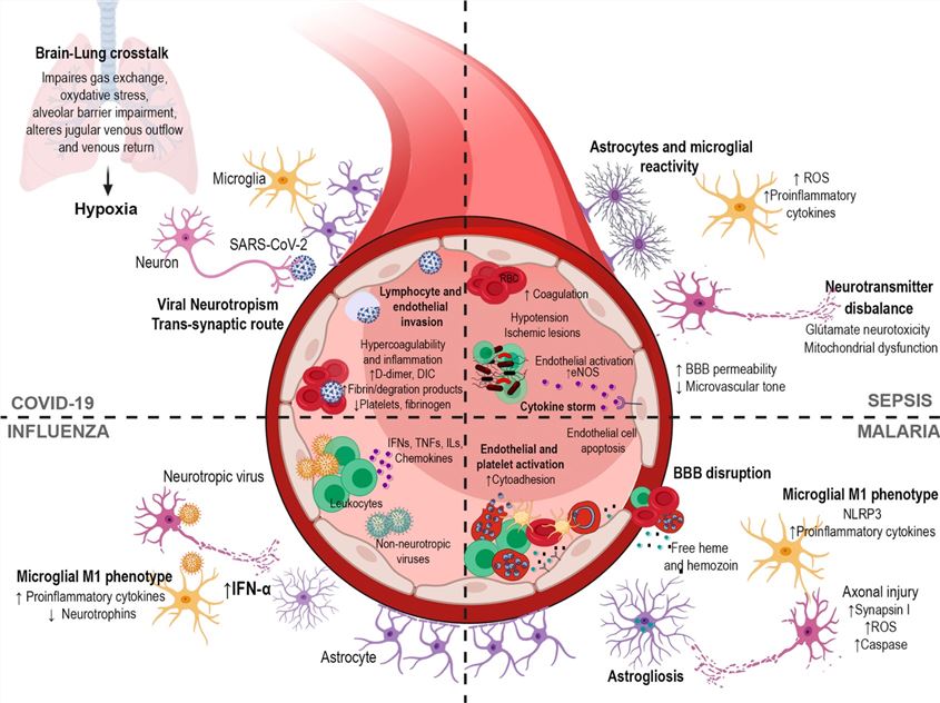 Fig.1 Molecular and cellular mechanisms of neuroinflammation. (OA Literature)