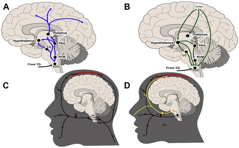 Fig.1 This schematic highlights the integration of ascending/descending pathways, trigeminocervical convergence, and autonomic reflexes in migraine pathophysiology. (OA Literature)