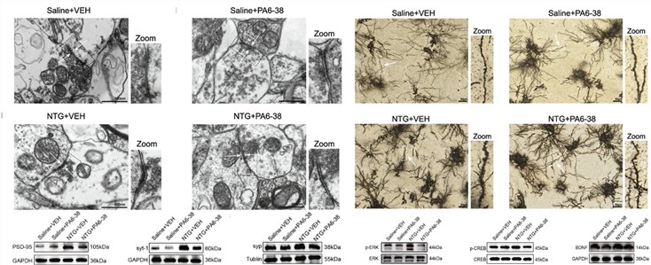 Fig.2 The therapeutic effect of PACAP6-38 in NTG induced chronic migraine rats. (OA Literature)