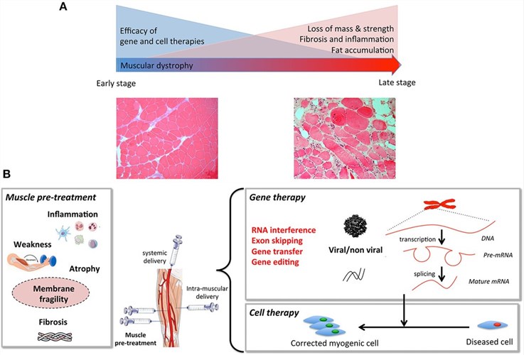 Fig.2 Optimizing gene and cell therapies requires integrated priming strategies that target inflammation and atrophy to counteract muscle degeneration, fibrosis, and fatty infiltration. (OA Literature)
