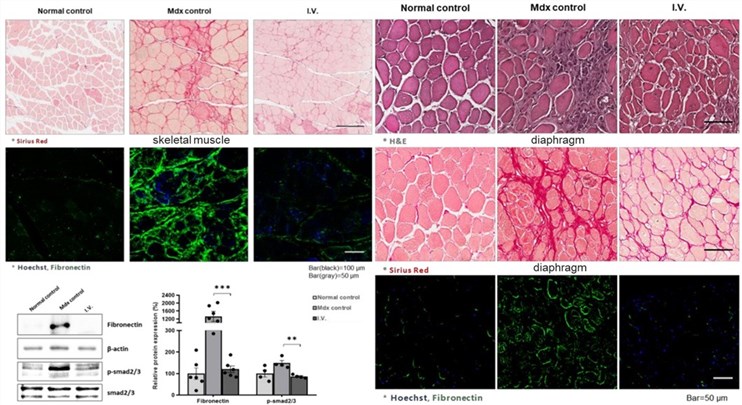 Fig.2 The therapeutic effect of WJ-MSCs in mdx mice. (OA Literature)