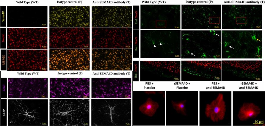Fig.2 The therapeutic effect of anti-SEMA4D antibody in Mecp2T158A/y mice. (OA Literature)