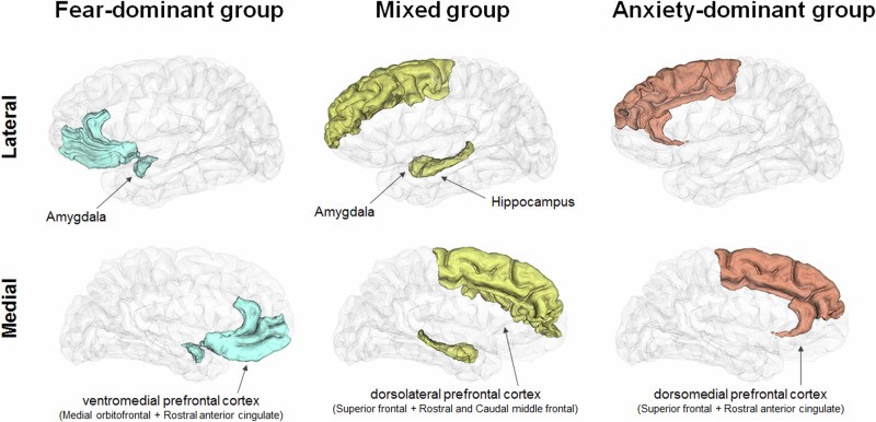 Fig.1 Anxiety disorders can be categorized into three groups based on behavior: fear-dominant (SP, AG), mixed (SAD, PD), and anxiety-dominant (GAD). Notably, the anxiety-dominant group is uniquely associated with HPA axis dysregulation. (OA Literature)