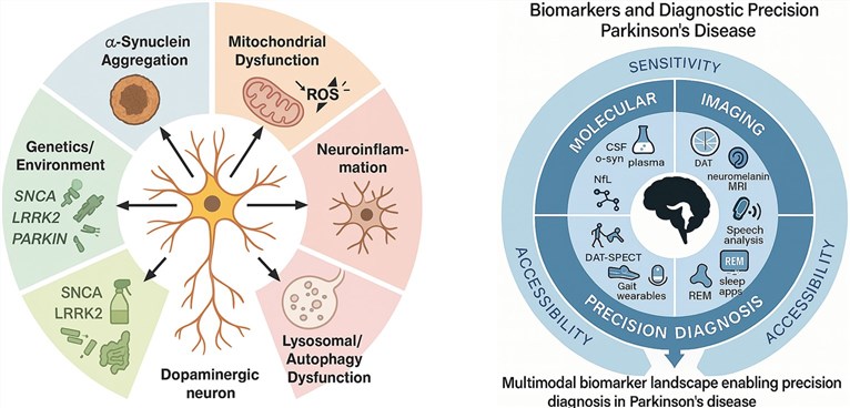 Fig.1 The introduction of Parkinson's disease. (OA Literature)